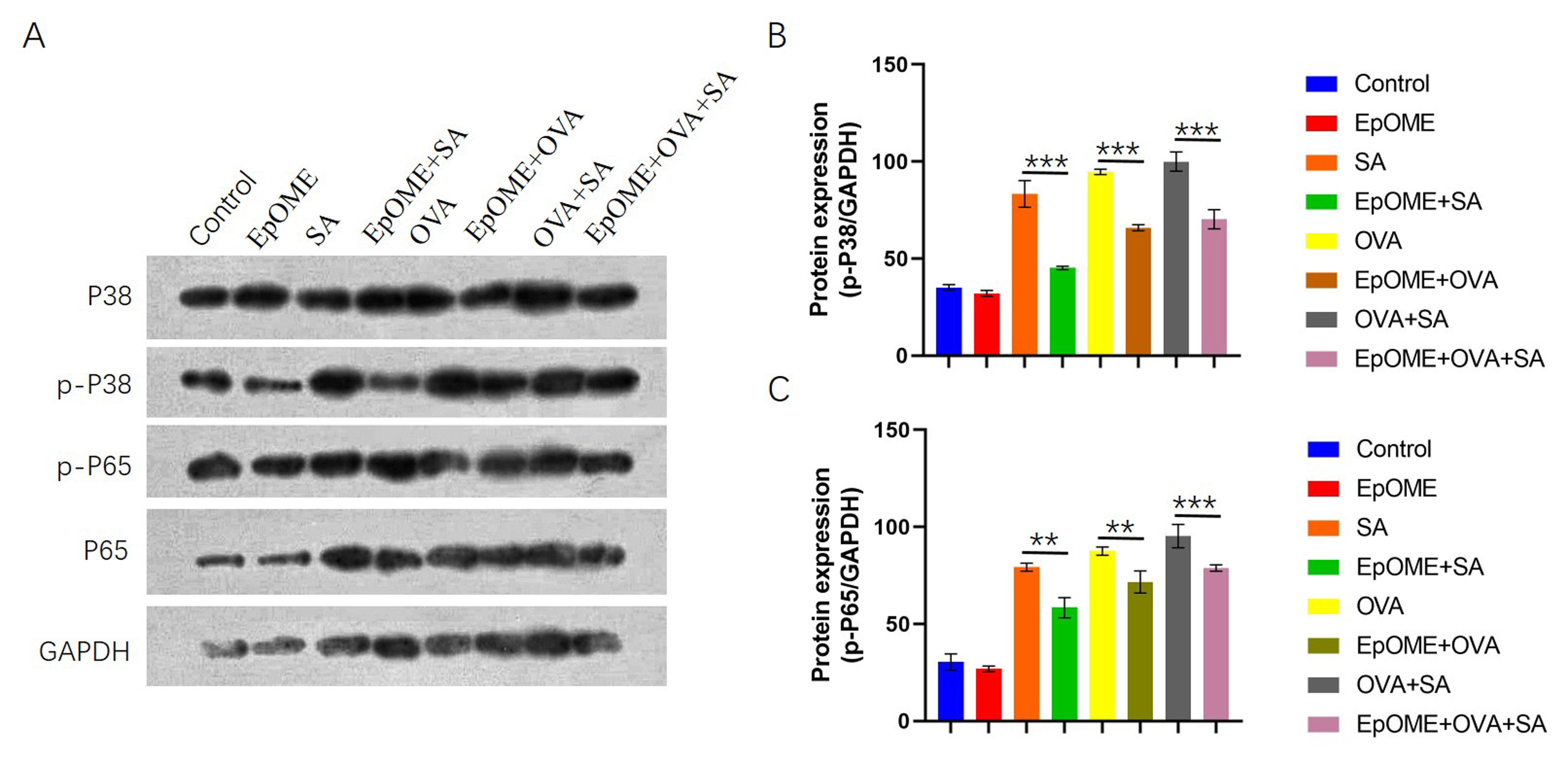EpOME Regulates Staphylococcus Aureus-Induced Allergic Airway Inflammation by Targeting the NF-κB a...
